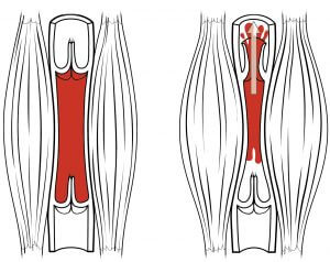 By OpenStax College - Anatomy & Physiology, Connexions Web site. http://cnx.org/content/col11496/1.6/, Jun 19, 2013., CC BY 3.0, https://commons.wikimedia.org/w/index.php?curid=30148264 Muscles restrict blood flow - doctor sarno back pain relief with joe polish